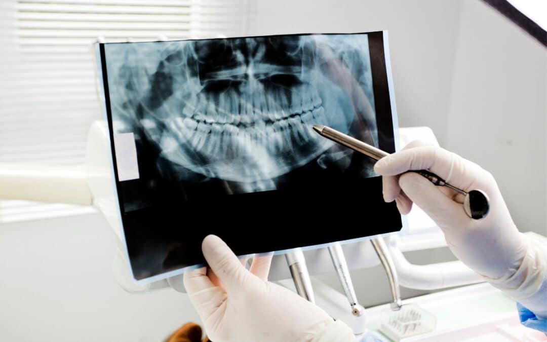 X-rays and Diagnostics: Unveiling the Secrets of General Dentistry