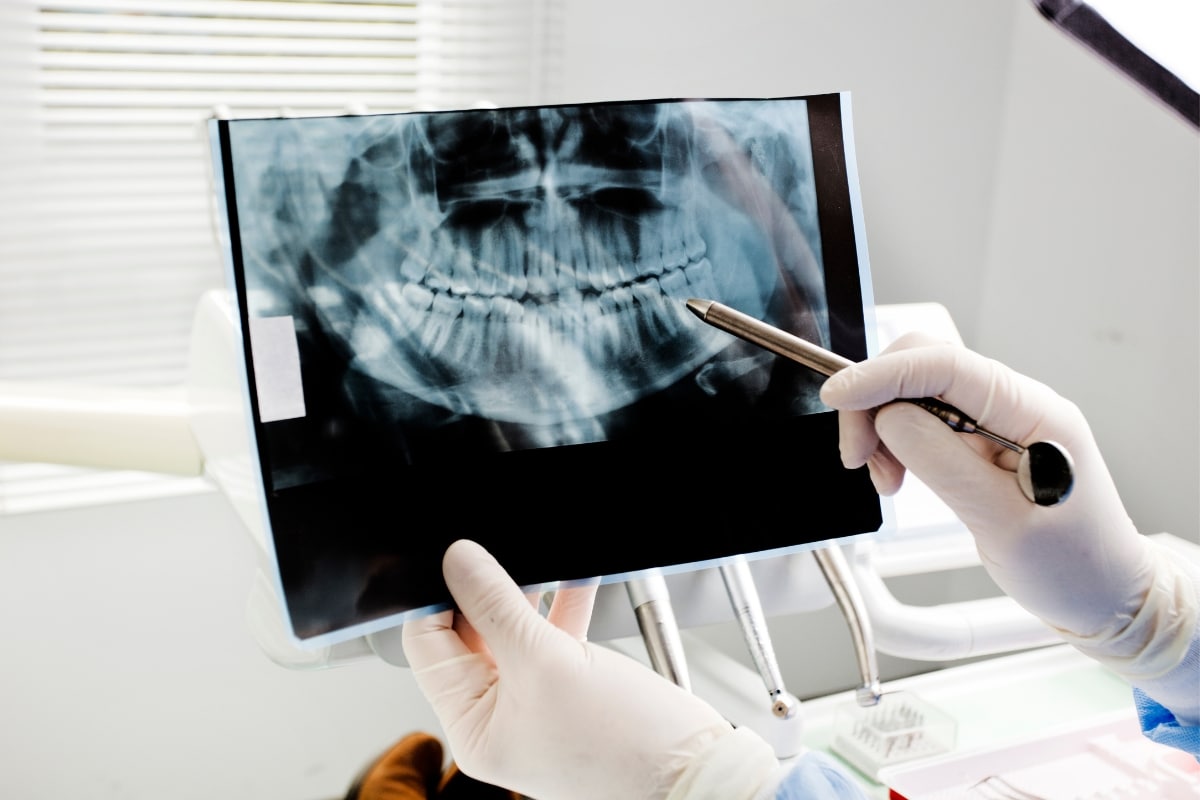 X-rays and Diagnostics: Unveiling the Secrets of General Dentistry
