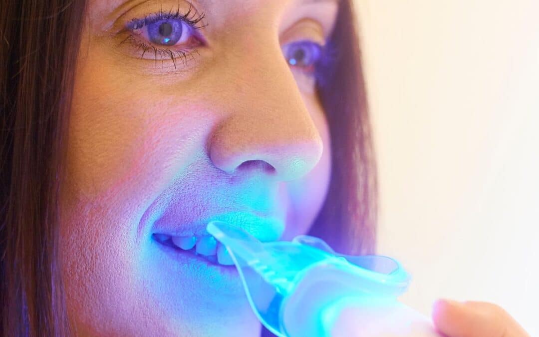 What Should I Eat After Teeth Whitening Treatment?