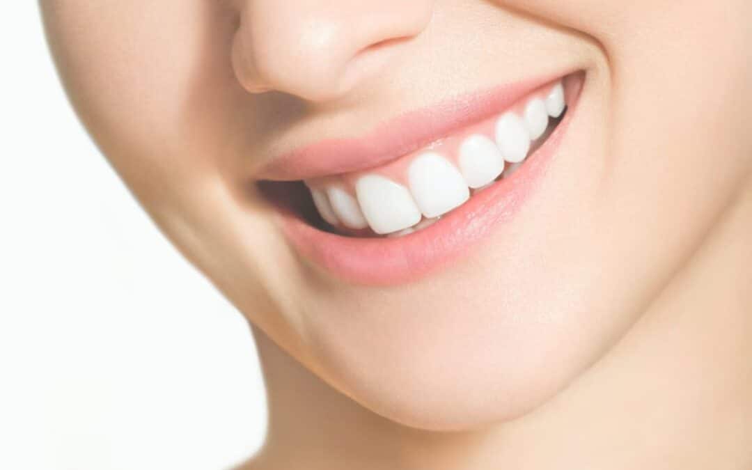 Can You Use Teeth Whitening on Dentures?