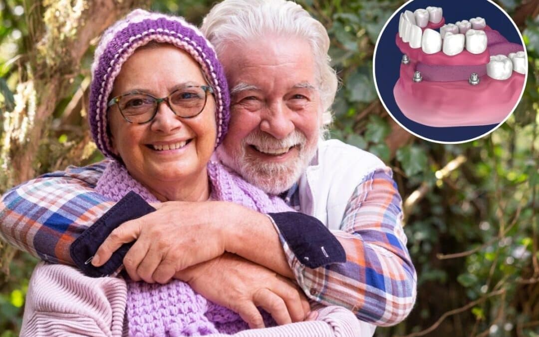 All-on-4 for Seniors: Restoring Teeth While Preserving Jaw Strength