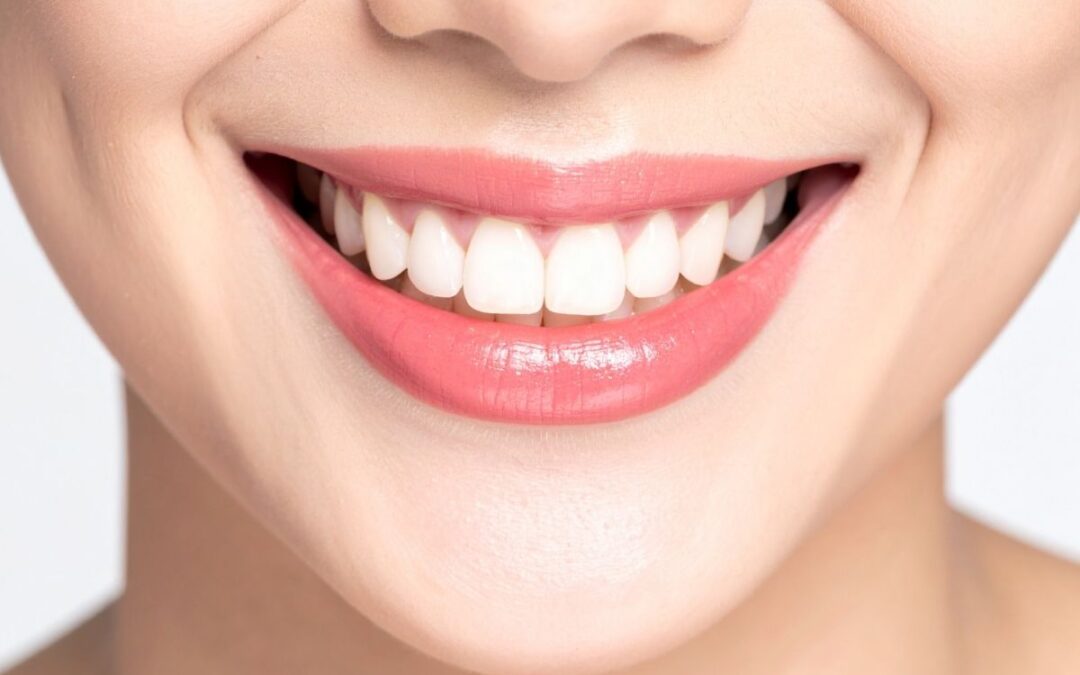 Straight Teeth at Home vs. Dentist-Supervised Treatment: Which Is Right for You?