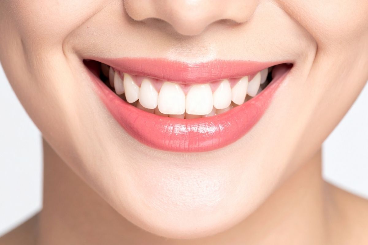 Straight Teeth at Home vs. Dentist-Supervised Treatment Straight Teeth