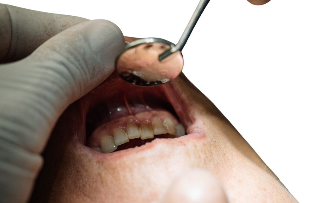 How to Stop Cavities Before They Start: Dentist-Approved Tips