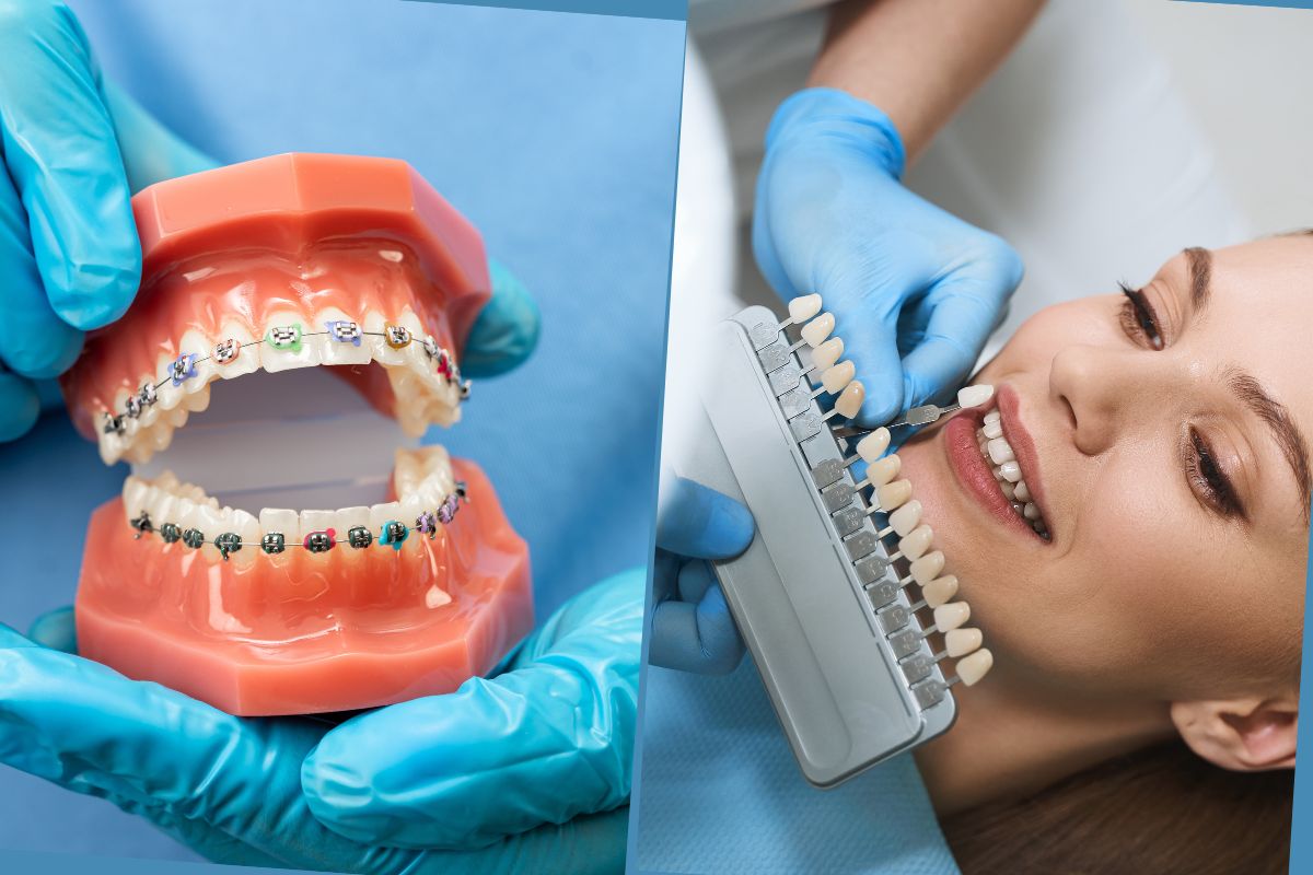 Cosmetic-vs-Orthodontic-Treatment Cosmetic vs Orthodontic Treatment