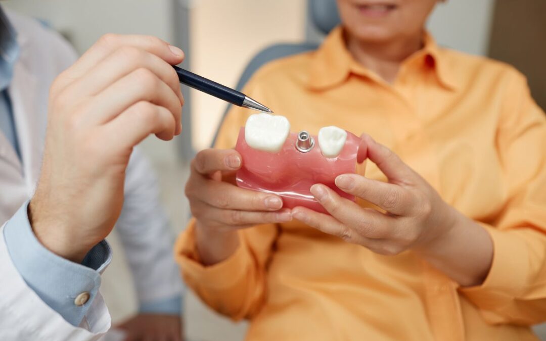 Dental Implant Recovery Timeline: How Long Does Healing Take?