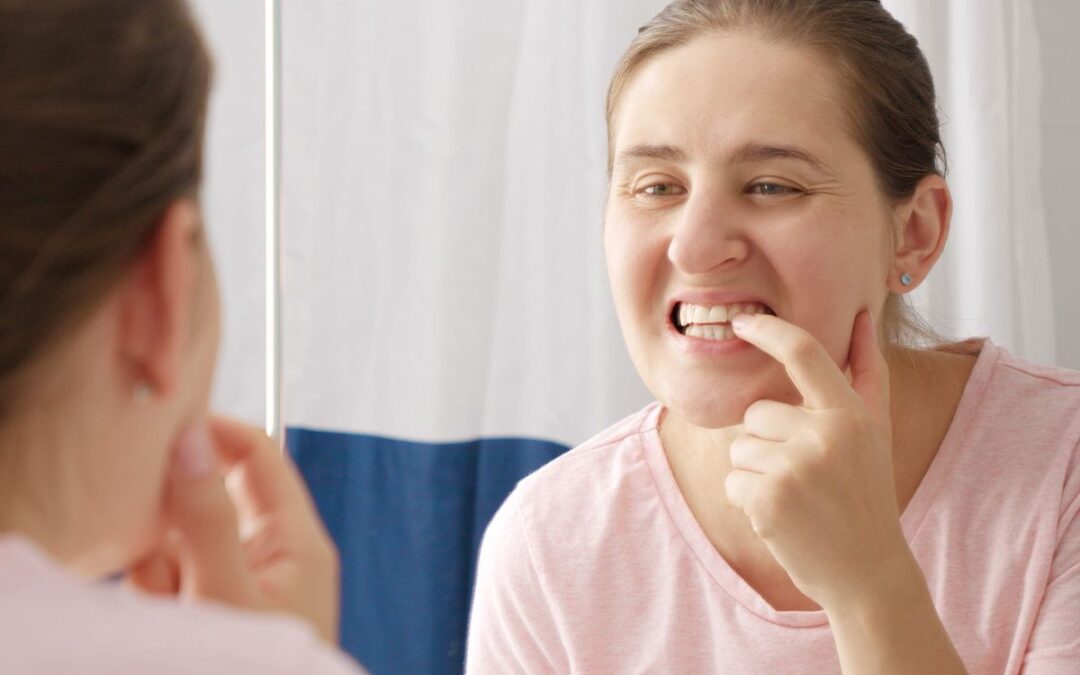 Yellow Teeth After Whitening: Causes and What to Do Next