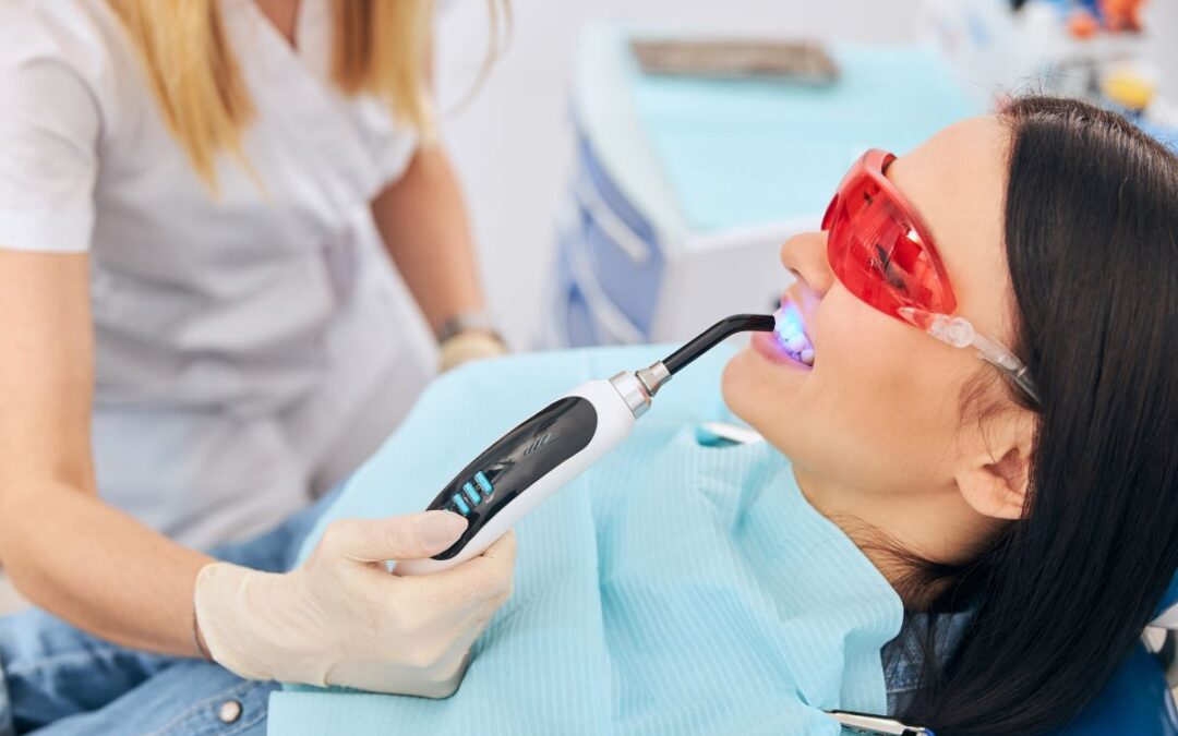 How Long Does Professional Teeth Whitening Last? Your Ultimate Guide to a Brighter Smile