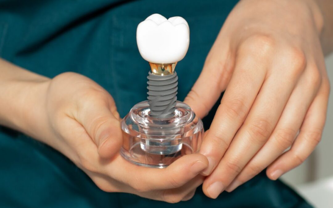 The Complete Guide to Dental Implant Failure: Common Causes and Warning Signs