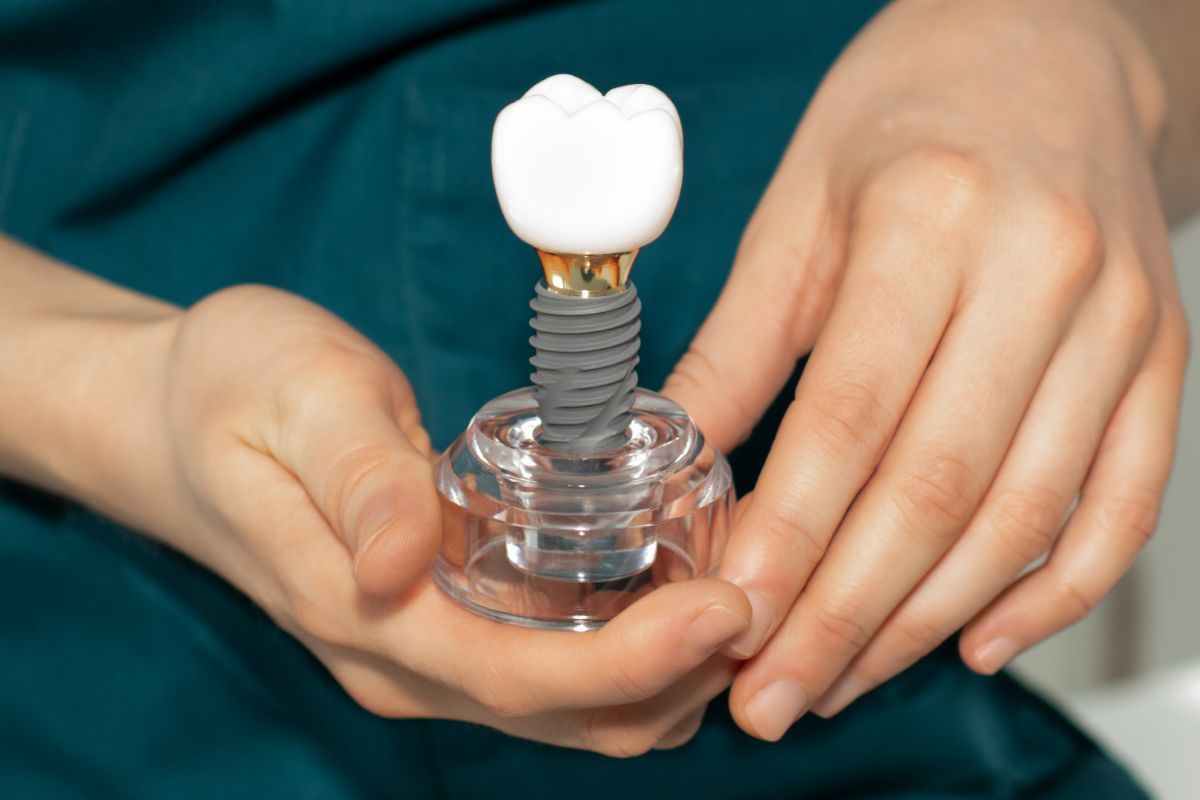 Why Do Dental Implants Fail