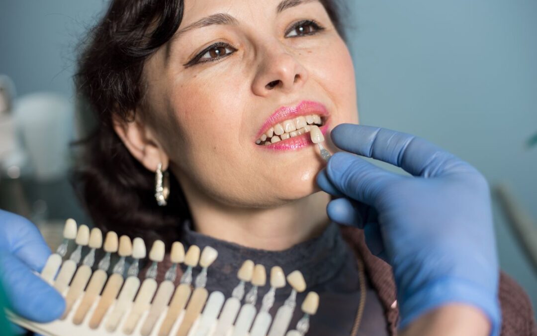 Why Won’t My Teeth Whiten? 7 Types of Stains Professional Whitening May Not Remove